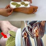 How to eliminate bed bugs – Powerful mix with cloves