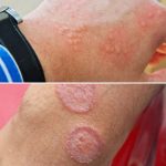 What You Eat with Eggs Can Affect Your Kidneys More Than You Think