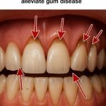 Easy Italian Apple Pie (Crostata di Mele)