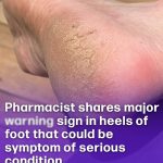 Grandma’s Surprising Onion and Clove Trick