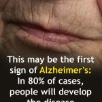 People who should not eat cabbage