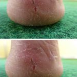 Garlic, Honey, and Cloves – a powerful natural remedy packed with health benefits