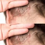 4 Nuts That Can Damage Your Brain (And 4 That Protect It From Dementia)