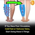 Banana Through Every Scan: What Does It Really Mean?