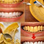 Doctors Reveal That Eating Peanuts Causes…