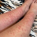 Different Types of Dough Recipes