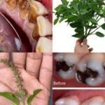 Small red dots keep spreading on my lower legs, and I can’t get checked yet. What can I do now?