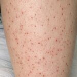 Holy Basil (Tulsi) for Oral Health: A Natural Remedy for Cavities, Gum Problems, Bad Breath & Stronger Teeth