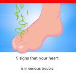 Scientifically Proven Health Benefits of Avocado and Avocado Seeds