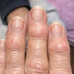 If This Appears on Your Hands, Be Careful. It Means You Have Ca…