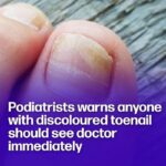 These are the consequences of sleeping with…