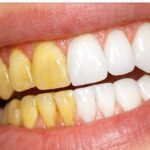 Creamy dill chicken salad