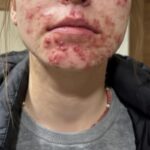 At Prom, Only One Boy Asked Me to Dance Because I Was in a Wheelchair – 30 Years Later, I Ran Into Him Again and He Needed Help