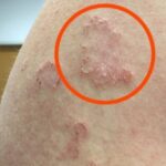 How Stress and Diet Affect Chin Hair Growth in Women